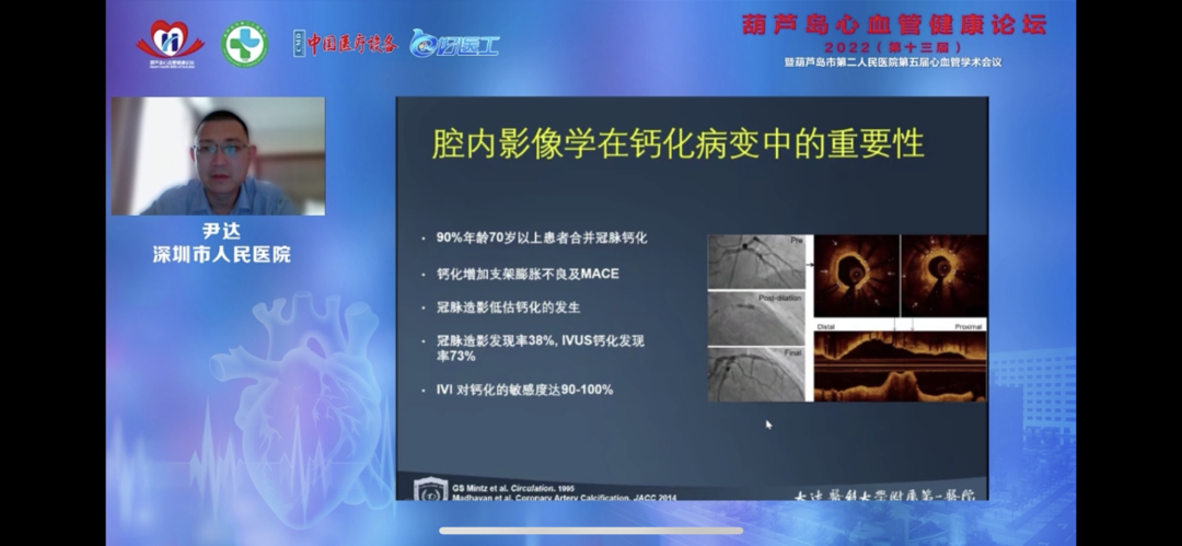 葫蘆島心血管健康論壇?2022｜創(chuàng)新驅(qū)動(dòng)發(fā)展，不斷提升心血管疾病救治能力(圖11)